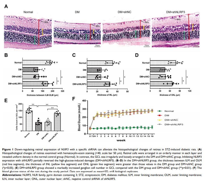 Figure 1 Down-regulating retinal expression of NLRP3 with a specific shRNA can...